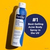 image:imagePanOxyl Acne Banishing Body Spray 2 Salicylic Acid For Body 6 oz6 Ounce Pack of 1
