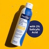 image:imagePanOxyl Acne Banishing Body Spray 2 Salicylic Acid For Body 6 oz6 Ounce Pack of 2