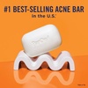 image:imagePanOxyl Acne Cleansing Bar 2 Salicylic Acid For Face amp Body 4 oz  Whole Body Cleansing Bar Helps Clear Acne Exfoliates with Mandelic Acid Zinc PCA Mattifies Shea Butter Moisturizes Vegan10 Benzoyl Peroxide