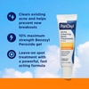 image:imagePanOxyl Acne Clearing Spot Treatment 10 Benzoyl Peroxide For Face 1 oz  Maximum Strength FastActing Clears amp Helps Prevent Acne Calms Redness With Allantoin Bisabolol amp Sodium Hyaluronate