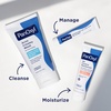 image:imagePanOxyl Adapalene 01 LeaveOn Gel Retinoid Gel Acne Treatment 30Day Supply Acne Prone Skin Oil Fragrance and Paraben Free 05 oz