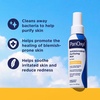 image:imagePanOxyl Antimicrobial Purifying Mist Hypochlorous Acid For Face 6 oz  Kills Bacteria Dermatologist Tested Purify Skin Calm Redness pH Balanced Hypoallergenic NonIrritating NonComedogenic3 Ounce Pack of 1