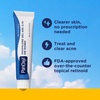 image:imagePanOxyl Face and Body Bundle  Acne Foaming Wash Benzoyl Peroxide 10 Acne Treatment Bar with 10 Benzoyl Peroxide amp Adapalene 01 LeaveOn Gel
