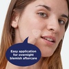 image:imagePanOxyl Blemish Brightening Patches DermatologistRecommended Help Fade PostAcne Dark Spots and Reduce Redness Large Clear Patches Cover a Bigger Area Vegan and LatexFree 16ct  ClinicallyProven Dermatologist Tested Helps Reduce Dark Spots amp Redness With Niacinamide Tranexamic Acid amp Vitamin C