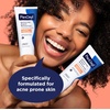 image:imagePanOxyl PM Balancing Repair Moisturizer with Niacinamide Ceramides and Cica Hydrating Face Moisturizer Acne Prone Skin and Dry Skin NonComedogenic Night Face Moisturizer 3 oz3 Fl Oz Pack of 1