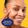 image:imagePanOxyl PM Overnight Spot Patches Advanced Hydrocolloid Healing Technology Fragrance Free 80 Count  MedicalGrade Covers Blemishes Prevents Picking LatexFree Fragrance amp ParabenFree Use Overnight For All Skin Types40 Count  Pack of 1